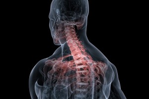 Anatomical illustration showing neck pain